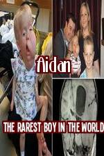 Watch Aidan The Rarest Boy In The World Vumoo