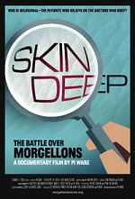 Watch Skin Deep: The Battle Over Morgellons Vumoo