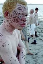 Watch Albino United Vumoo