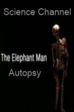 Watch Science Channel Elephant Man Autopsy Vumoo