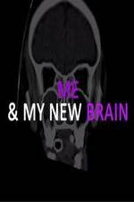 Watch Me & My New Brain Vumoo