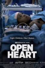 Watch Open Heart Vumoo