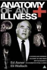 Watch Anatomy of an Illness Vumoo