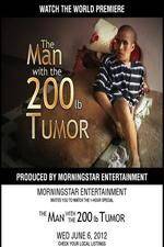Watch The Man With The 200lb Tumor Vumoo