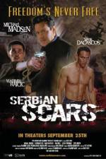 Watch Serbian Scars Vumoo