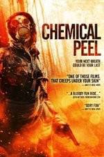 Watch Chemical Peel Vumoo