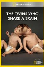 Watch National Geographic The Twins Who Share A Brain Vumoo