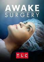 Watch Awake Surgery Vumoo
